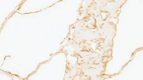 Calacatta Oro Macchia quartz slab: amber-gold veins and a broad flecked gold band on bright white